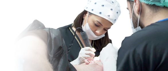 Laser Hair Transplant