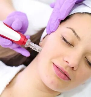 microneedling facial near me