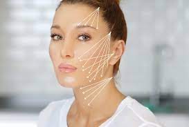 What is Thread Lift