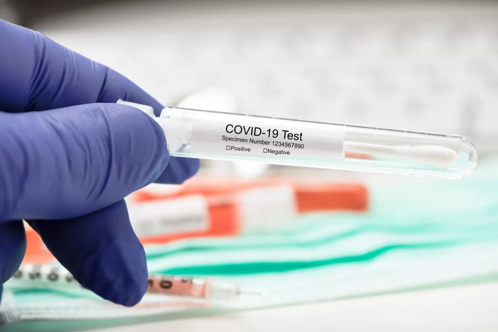 RT PCR test