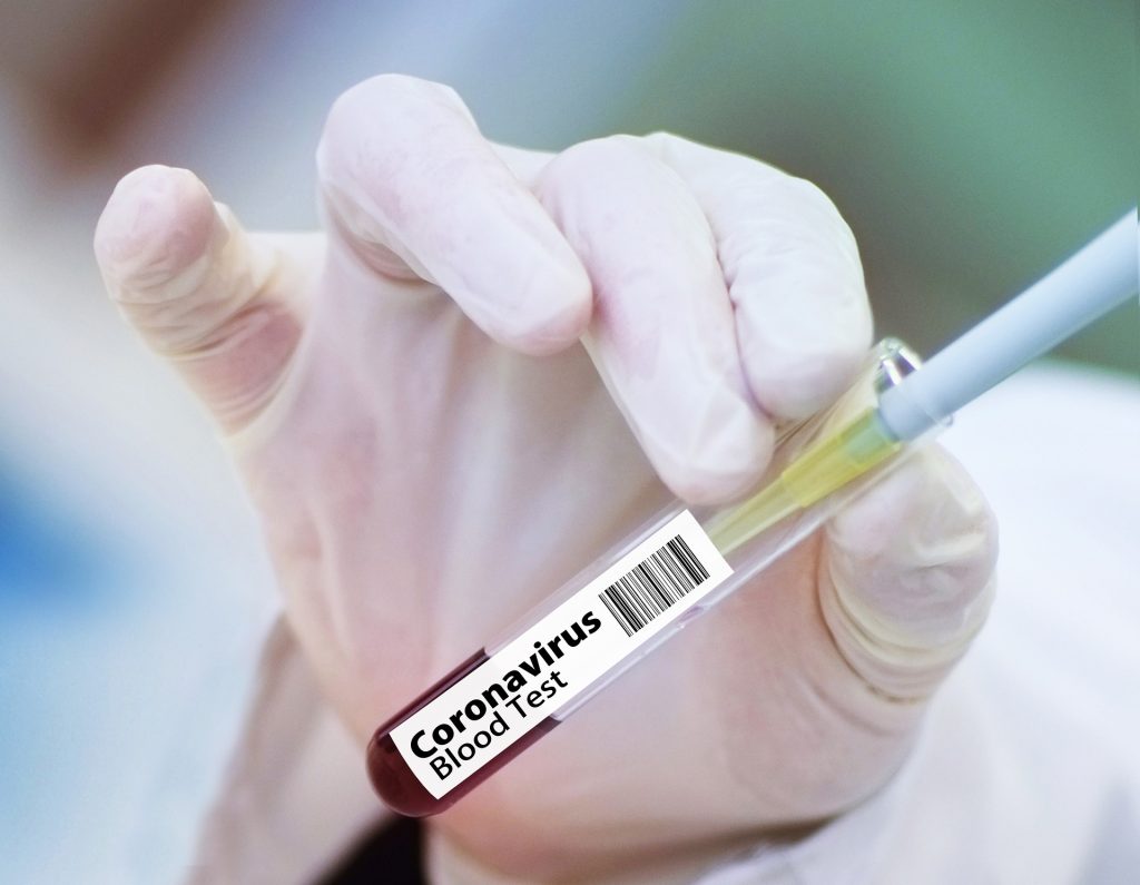 RT PCR test