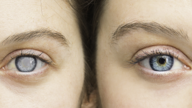 Glaucoma - Image