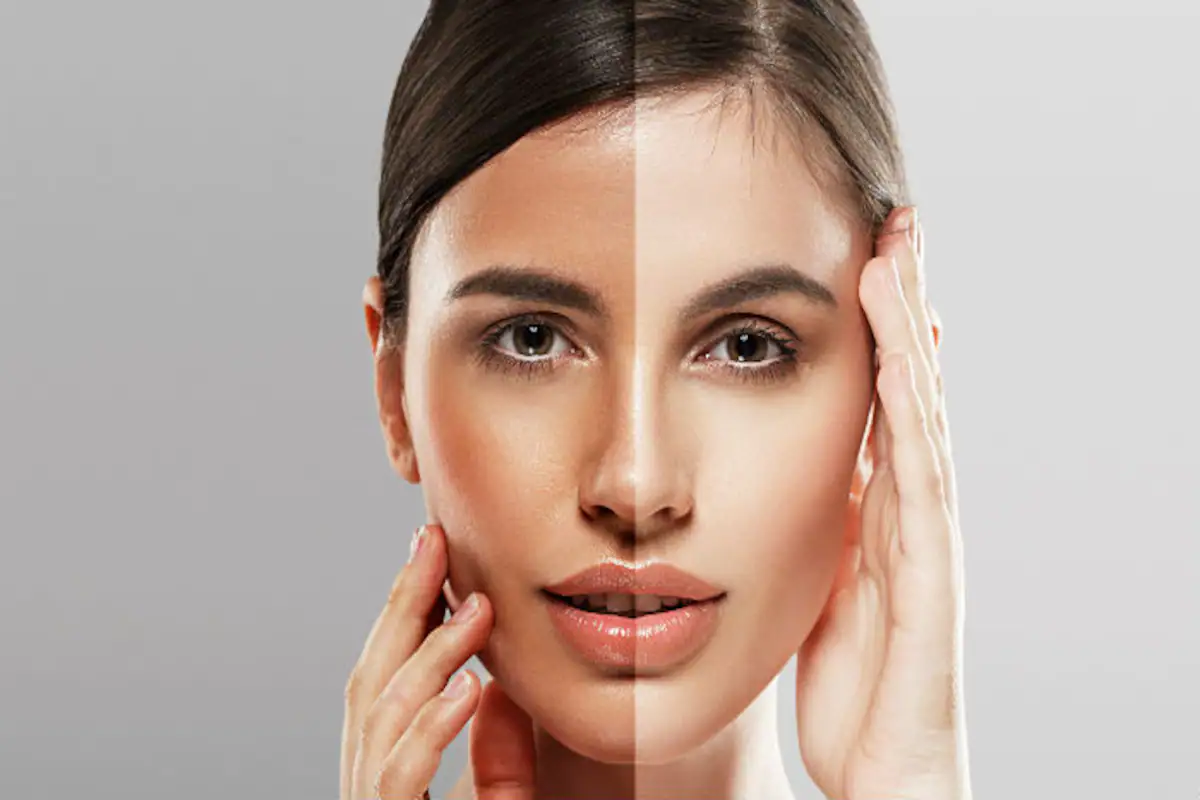 How to Get Clear Skin?